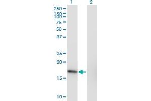 Western Blot analysis of SNX3 expression in transfected 293T cell line by SNX3 monoclonal antibody (M10), clone 3A9. (Sorting Nexin 3 antibody  (AA 1-113))
