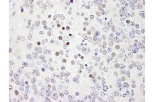 Immunohistochemistry (IHC) image for anti-Werner Helicase Interacting Protein 1 (WRNIP1) (AA 400-450) antibody (ABIN7449035) (WRNIP1 antibody  (AA 400-450))