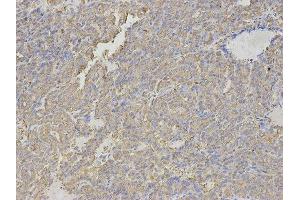 Immunohistochemistry (IHC) image for anti-Histamine N-Methyltransferase (HNMT) antibody (ABIN1873063) (HNMT antibody)