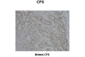 CPS1 antibody  (Middle Region)