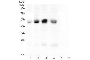 Western blot testing of CAR antibody and rat samples 1: pancreas (Coxsackie Adenovirus Receptor antibody  (C-Term))