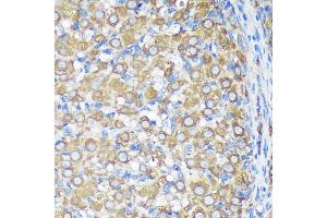 Immunohistochemistry of paraffin-embedded Rat ovary using  Rabbit pAb (ABIN7265696) at dilution of 1:100 (40x lens). (ALG5 antibody  (AA 34-190))