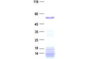Validation with Western Blot (ZNF181 Protein (His tag))