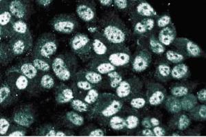 Immunofluorescence staining of human endothelial cells. (HDAC3 antibody  (AA 309-425))