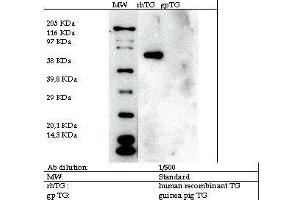 Image no. 2 for anti-Transglutaminase 2 (C Polypeptide, Protein-Glutamine-gamma-Glutamyltransferase) (TGM2) antibody (ABIN347019) (Transglutaminase 2 antibody)