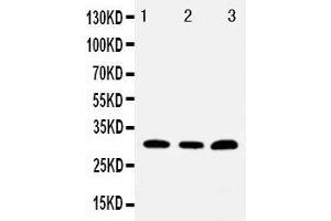 Anti-Tollip antibody, Western blotting Lane 1: PANC Cell Lysate Lane 2: HELA Cell Lysate Lane 3: U87 Cell Lysate