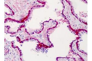 Human Prostate: Formalin-Fixed, Paraffin-Embedded (FFPE) (SLFN12 antibody  (C-Term))