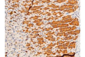 ABIN6267308 at 1/100 staining rat gastric tissue sections by IHC-P. (C-JUN antibody  (pTyr170))