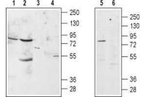 ADRA1B antibody  (Extracellular, N-Term)