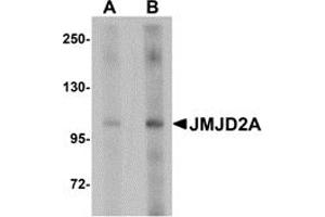 Western Blotting (WB) image for anti-Lysine (K)-Specific Demethylase 4A (KDM4A) (Middle Region) antibody (ABIN1030968) (KDM4A antibody  (Middle Region))