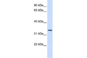 WB Suggested Anti-FBXO25 Antibody Titration:  0. (FBXO25 antibody  (N-Term))