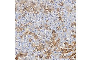 anti-Hemochromatosis (HFE) (AA 112-227) antibody