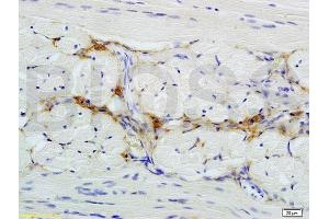 Formalin-fixed and paraffin embedded rat tongue tissue labeled with Anti-CD47/MER6 Polyclonal Antibody, Unconjugated (ABIN739530) at 1:200 followed by conjugation to the secondary antibody
