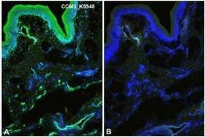 Immunofluorescence staining (green) of Human foreskin (cryo-section of unfixed tissue) with anti-Human CCM3 antibody Cat. (PDCD10 antibody  (N-Term))