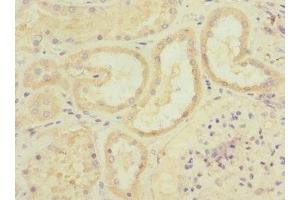 Immunohistochemistry of paraffin-embedded human kidney tissue using ABIN7150046 at dilution of 1:100 (ADAM19 antibody  (AA 203-460))