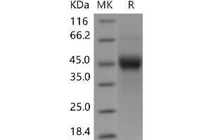 Western Blotting (WB) image for Tumor-Associated Calcium Signal Transducer 2 (TACSTD2) (Active) protein (His tag) (ABIN7198529) (TACSTD2 Protein (His tag))