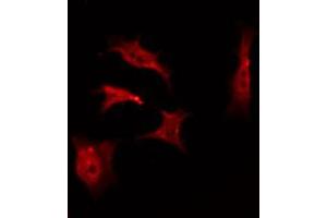Immunofluorescence (fixed cells) (IF/ICC) image for anti-Protein Kinase C, alpha (PKCa) (pThr638) antibody (ABIN6255718)