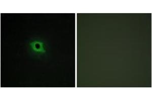Immunofluorescence analysis of COS7 cells, using DGKK Antibody. (DGKK antibody  (AA 1221-1270))