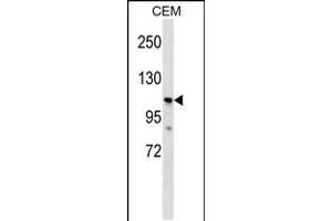 Western blot analysis in CEM cell line lysates (35ug/lane). (PKD2L1 antibody  (N-Term))