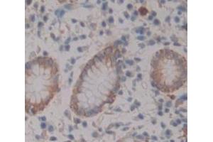 Figure. (ADAM28 antibody  (AA 525-774))