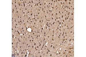 IHC analysis of KLF15 using anti-KLF15 antibody (ABIN7599269). (KLF15 antibody  (AA 1-323))