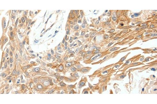 SCN11A antibody