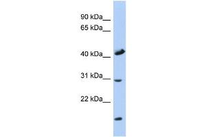 WB Suggested Anti-COX18 Antibody Titration: 0. (COX18 antibody  (Middle Region))