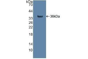 Detection of Recombinant citrate synthase, Human using Polyclonal Antibody to Citrate Synthase (CS) (CS antibody  (AA 103-394))