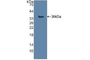 Detection of Recombinant citrate synthase, Human using Polyclonal Antibody to Citrate Synthase (CS)