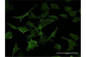 Immunofluorescence of monoclonal antibody to GUCY2D on HeLa cell. (GUCY2D antibody  (AA 521-630))