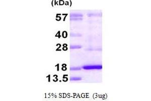 SDS-PAGE (SDS) image for Dual Specificity Phosphatase 19 (DUSP19) (AA 65-217) protein (His tag) (ABIN667987) (DUSP19 Protein (AA 65-217) (His tag))