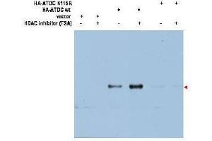 Western blot using  affinity purified anti-ATDC (Ac-K116) antibody shows detection of a 66 kDa band corresponding to over-expressed, acetylated lysine (K116) ATDC (arrowhead) in transfected 293T cells.