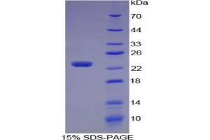 SDS-PAGE analysis of Human Stathmin 1 Protein.