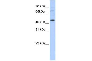 WB Suggested Anti-LMX1A Antibody Titration:  5. (LMX1A antibody  (C-Term))