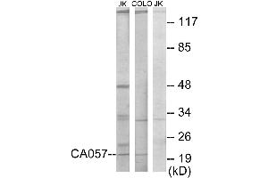 Western blot analysis of extracts from Jurkat cells and COLO205 cells, using CA057 antibody. (C1orf57 antibody)