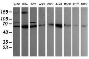 Image no. 2 for anti-SEC14 and Spectrin Domains 1 (SESTD1) antibody (ABIN1501067)