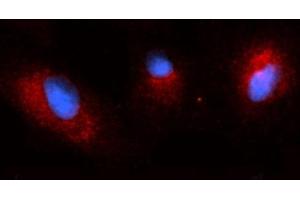 Immunofluorescence (IF) image for anti-Osteoactivin (GPNMB) (AA 22-474) antibody (PE) (ABIN5566465) (Osteoactivin antibody  (AA 22-474) (PE))