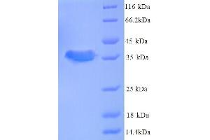 SDS-PAGE (SDS) image for Cerebral Palsy, Ataxic 1 (CPAT1) (AA 1-77), (full length) protein (GST tag) (ABIN5713694)