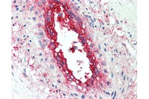 Anti-EHD2 antibody IHC staining of human vessel. (EHD2 antibody  (AA 529-542))