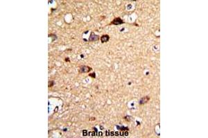Formalin-fixed and paraffin-embedded human brain tissue with UNC5C Antibody (Center), which was peroxidase-conjugated to the secondary antibody, followed by DAB staining.