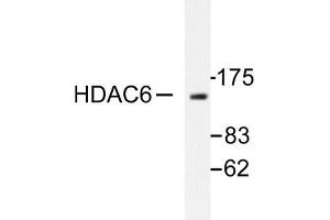 Image no. 1 for anti-Histone Deacetylase 6 (HDAC6) antibody (ABIN265458) (HDAC6 antibody)