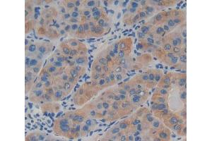Used in DAB staining on fromalin fixed paraffin- embedded Kidney tissue (LAMb4 antibody  (AA 1543-1759))