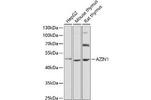 Western blot analysis of extracts of various cell lines, using  antibody (ABIN6129201, ABIN6137388, ABIN6137389 and ABIN6220750) at 1:3000 dilution.