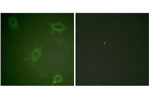 Immunofluorescence staining of methanol-fixed HeLa cells using Amyloid β A4 (phospho-Thr743/668) Antibody. (APP antibody  (pThr743))