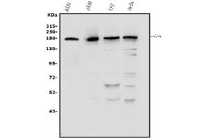 Western blot analysis of EGFR using anti-EGFR antibody (ABIN7599622).