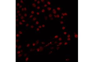 ABIN6266824 staining 293 by IF/ICC. (ZMYND8 antibody  (Internal Region))