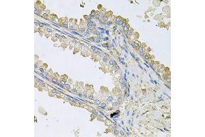 Immunohistochemistry of paraffin-embedded human prostate using PPIC antibody (ABIN6003569) at dilution of 1/100 (40x lens). (PPIC antibody)