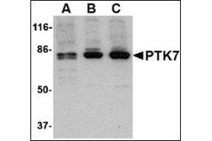 Western blot analysis of PTK7 in (A) human, (B) mouse and (C) rat colon tissue lysate with this product at 1 μg/ml.