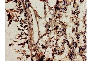 Immunocytochemistry analysis of human lung tissue using ABIN7161498 at dilution of 1:100 (NCF2 antibody  (AA 178-526))