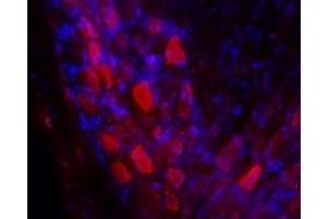 Expression of Galanin receptor 2 in rat DRGImmunohistochemical staining of rat dorsal root ganglia (DRG) frozen sections using Anti-GALR2 Antibody (ABIN7043181, ABIN7044398 and ABIN7044399), (1:100). (Galanin Receptor 2 (GALR2) Peptide)